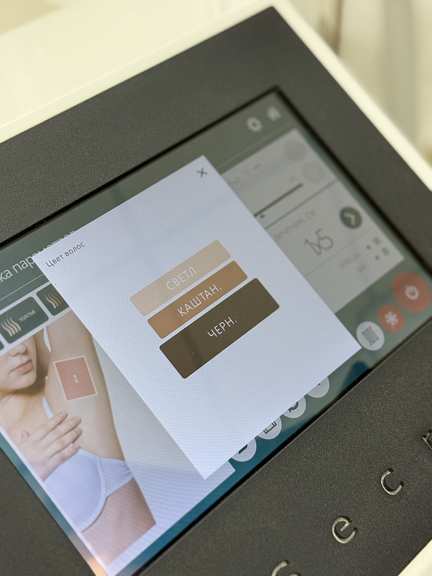 Фото 3 - Лазерна епіляція на найпотужнішому діодному лазері в Україні